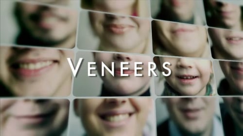 Veneers